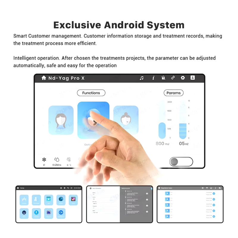 yag-neolasersmart - kép 3