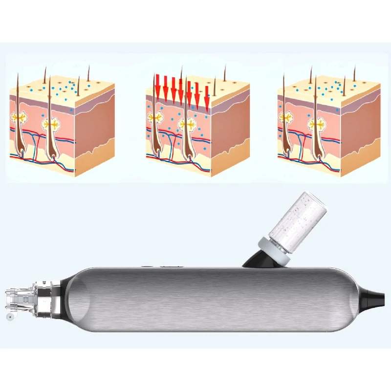 HydraCrown Expert - 5. kép